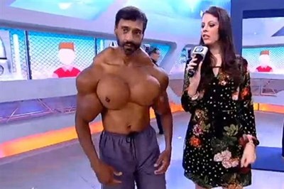 بالفيديو ..  برتغالي يشوه جسمه بحقن تضخيم العضلات