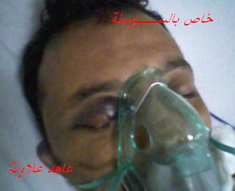 وزير الداخلية يطمئن على صحة العلاونة في مدينة الحسين الطبية 