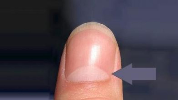 mainThumb