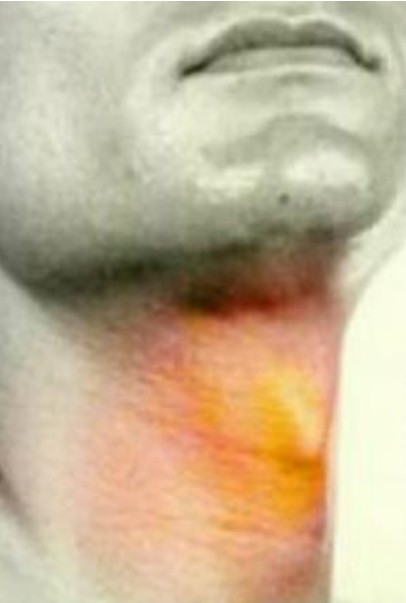 mainThumb