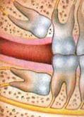 mainThumb