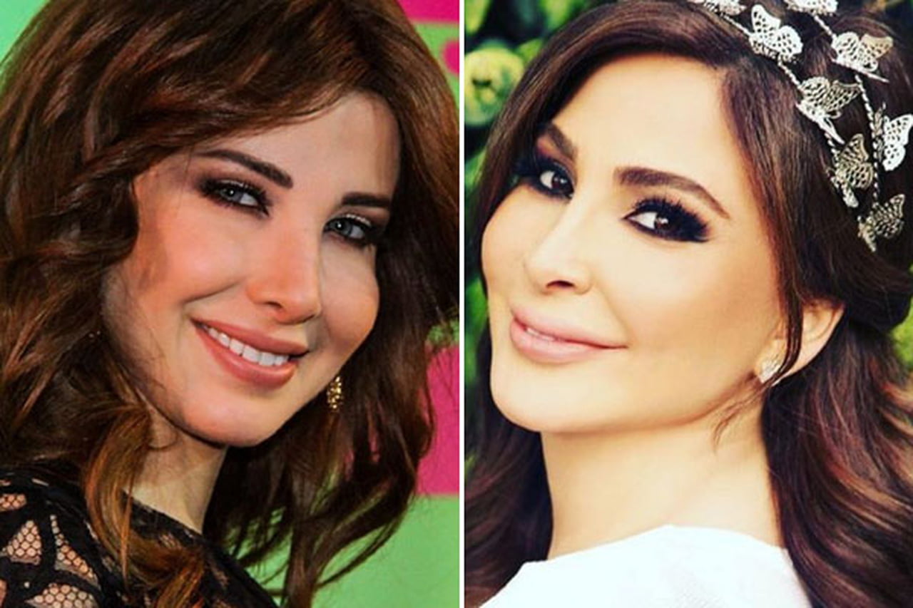 نانسي عجرم توجه رسالة إلى إليسا بعد خضوع الأخيرة لعملية جراحية