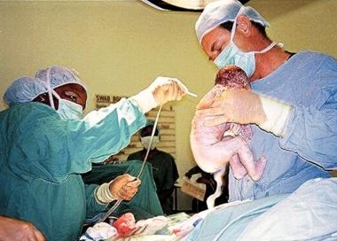 قبل ساعات من الولادة .. علمت أنها حامل 