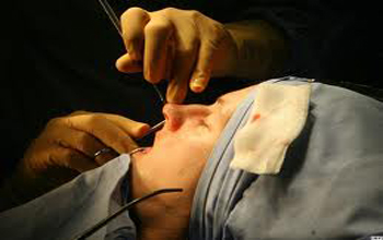 جراحة التجميل تخفف الصداع النصفي