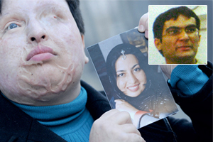 محكمة تقضي بفقء عين رجل تسبب بعمى محبوبته