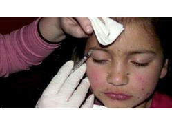 أم تحقن طفلتها إبر بوتوكس لتشارك في مسابقة جمال