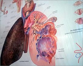 تطوير صمامات قلب دائمة