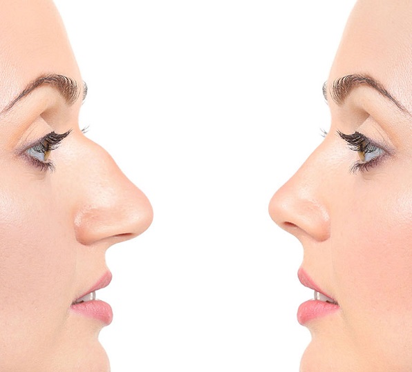  هل يجوز اخفاء عمليات التجميل عن الزوج ؟