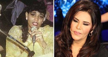 ممنوع دخول أصحاب القلوب الضعيفة ..  شاهد نجمات الخليج قبل وبعد عمليات التجميل