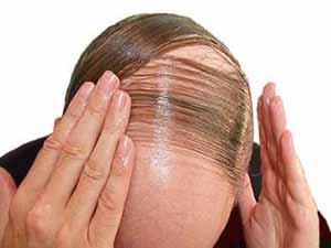 mainThumb